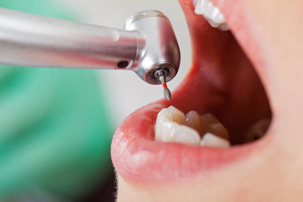Best Emergency Treatment for Oral Infections in Cleveland, GA